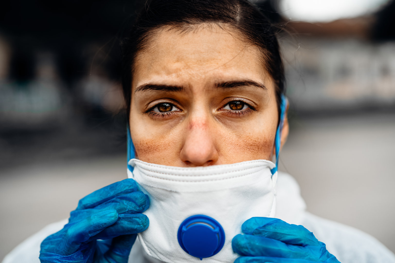 Exhausted doctor/nurse wearing coronavirus protective gear N95 mask uniform.Coronavirus Covid-19 outbreak.Mental stress of frontline worker.Face scars.Mask shortage.Overworked healthcare professional